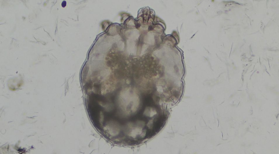 Sarcoptes scabiei im oberflächlichen Hautgeschabsel