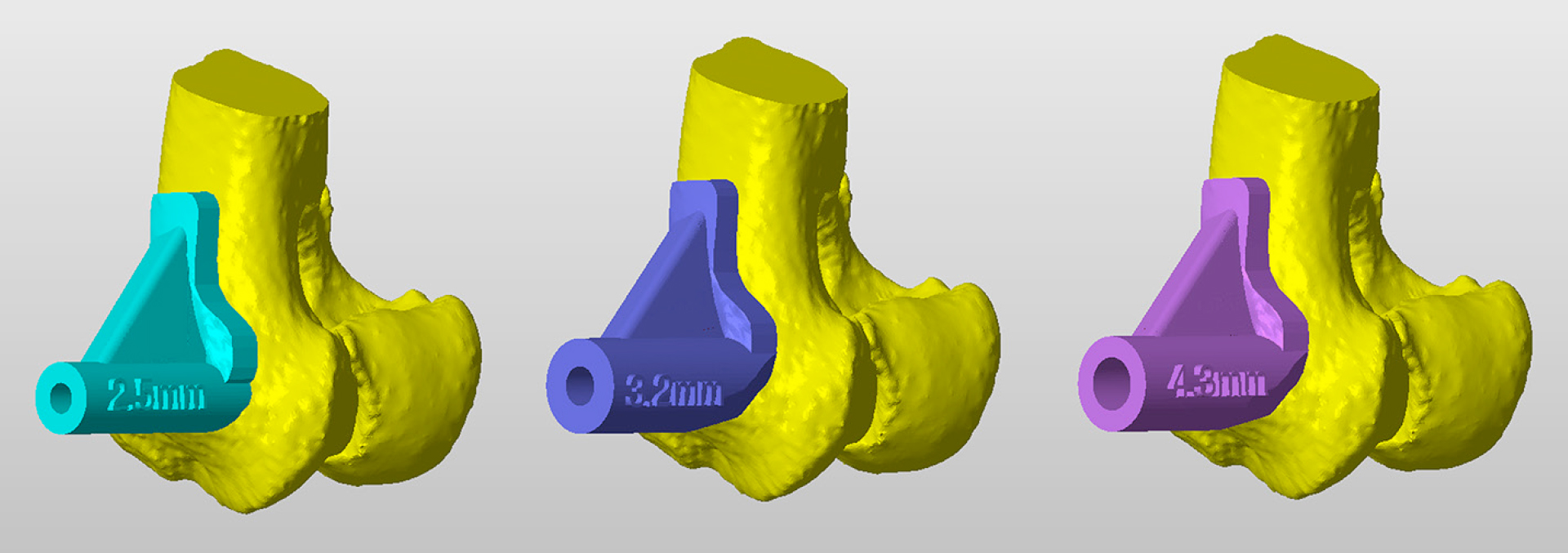 3-D-Druck