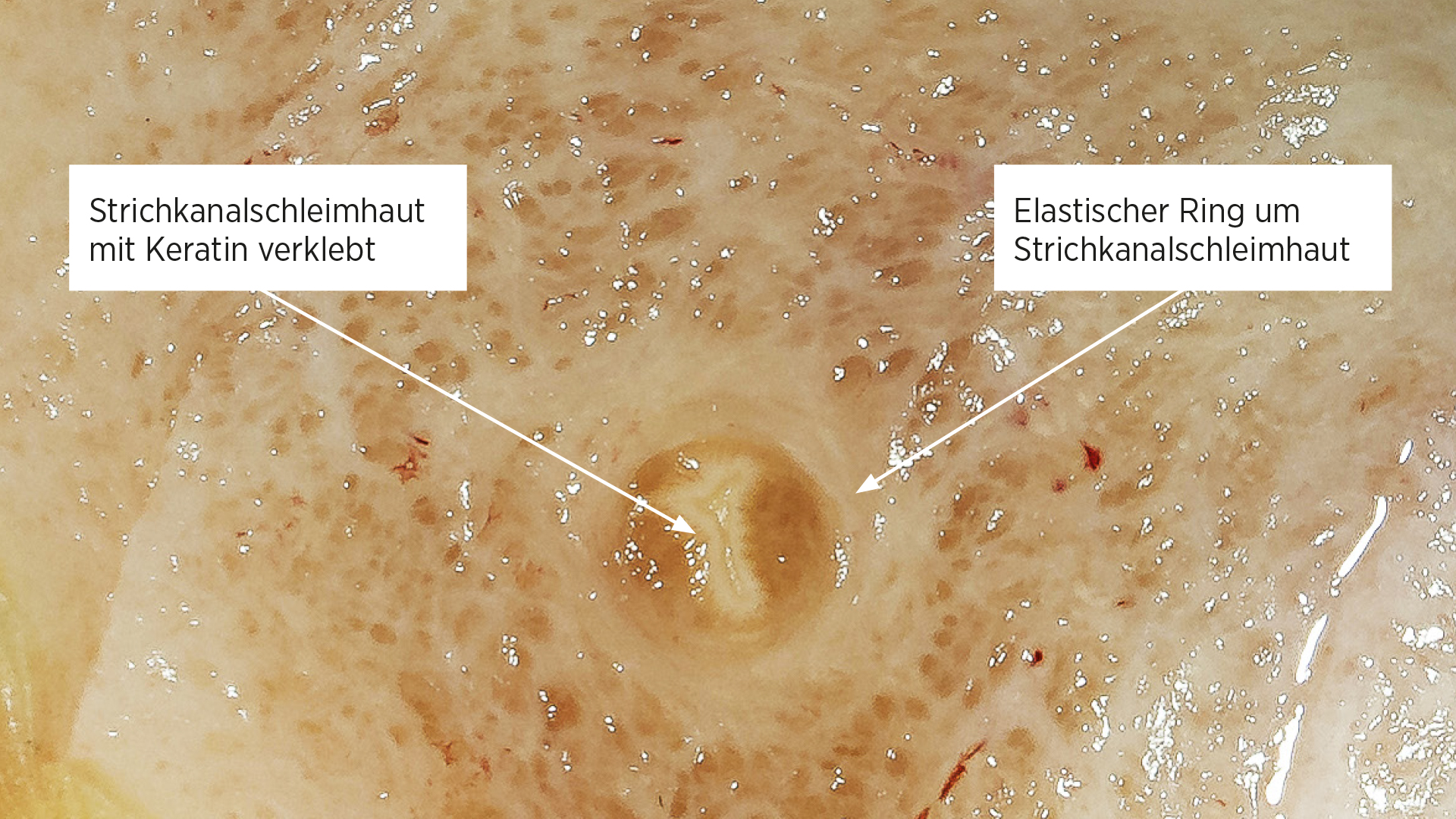 Trockenstellen