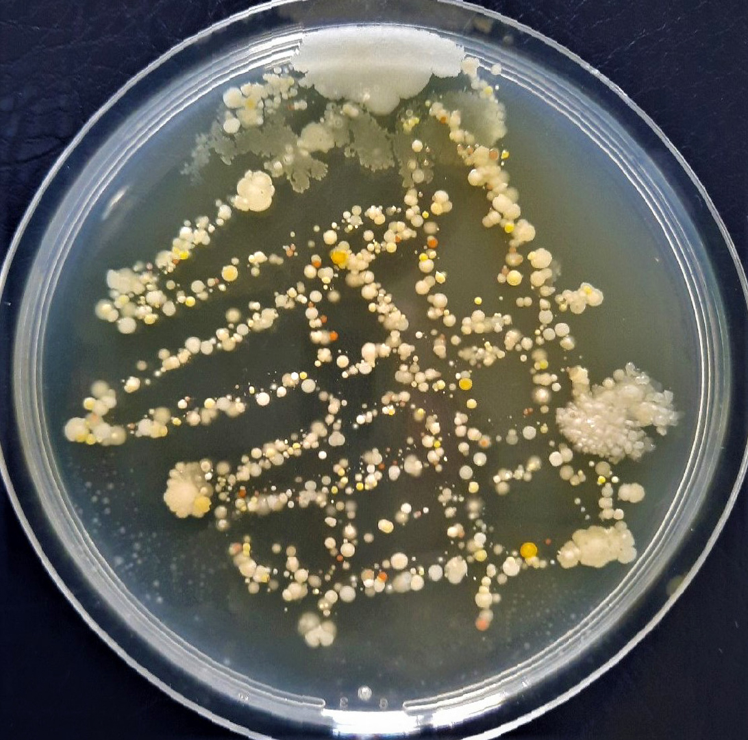Mikrobiome und pathogene Keime