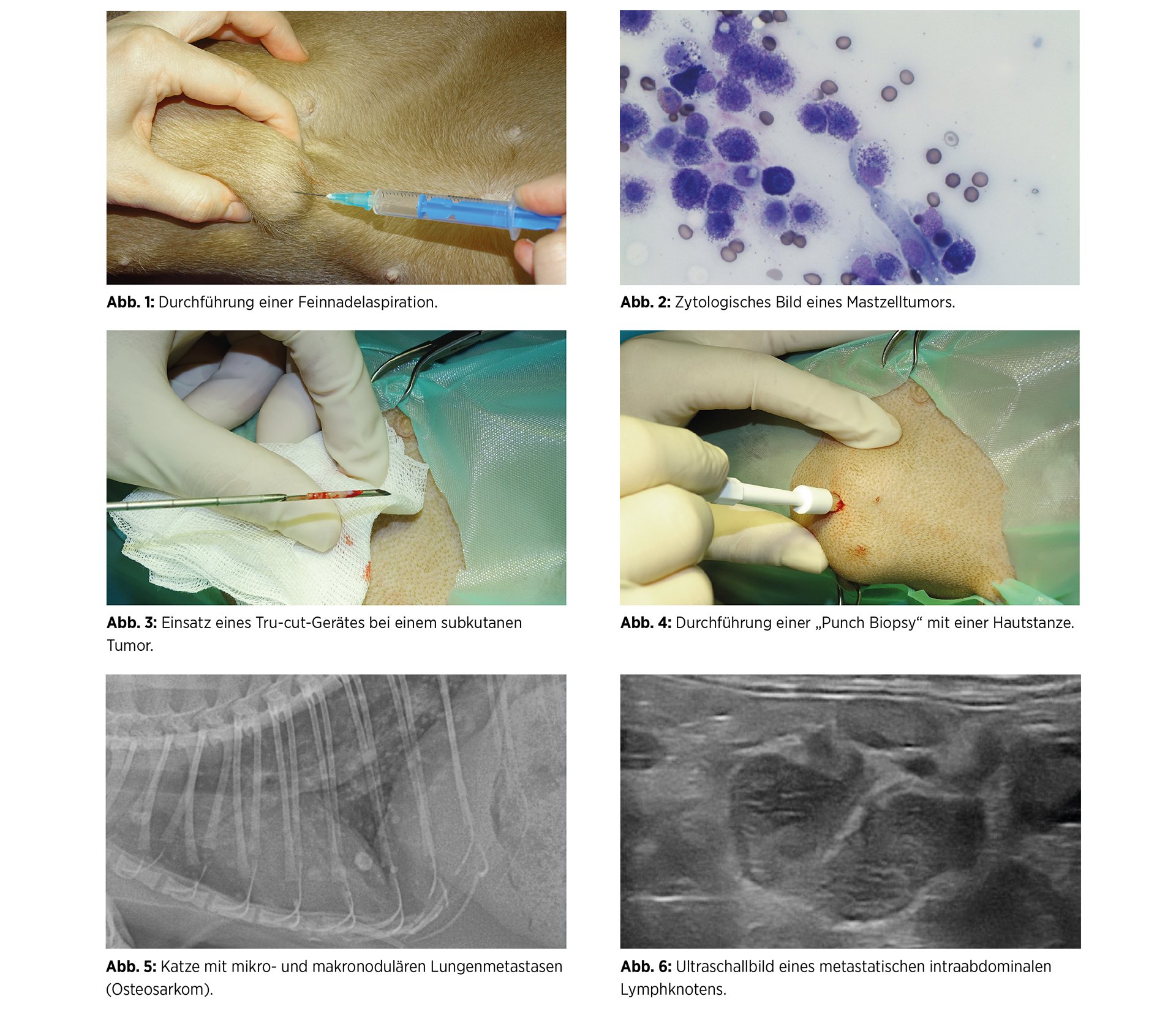 Tumorstaging